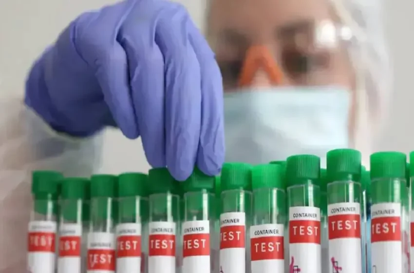  चेन्नई में बर्ड फ्लू का अलर्ट: सैकड़ों कौवों की मौत, H5N1 वायरस की पुष्टि, सरकार ने जारी की सख्त एडवाइजरी