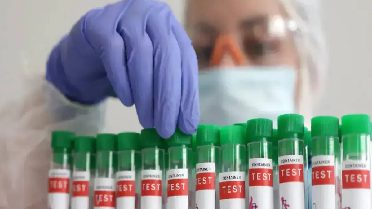 चेन्नई में बर्ड फ्लू का अलर्ट: सैकड़ों कौवों की मौत, H5N1 वायरस की पुष्टि, सरकार ने जारी की सख्त एडवाइजरी