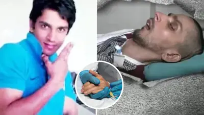 हरीश राणा केस: क्या है क्वाड्रिप्लेजिया? जानिए इस गंभीर स्थिति के कारण और प्रभाव